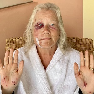 Morning after the night before