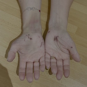 Wrists took abashing